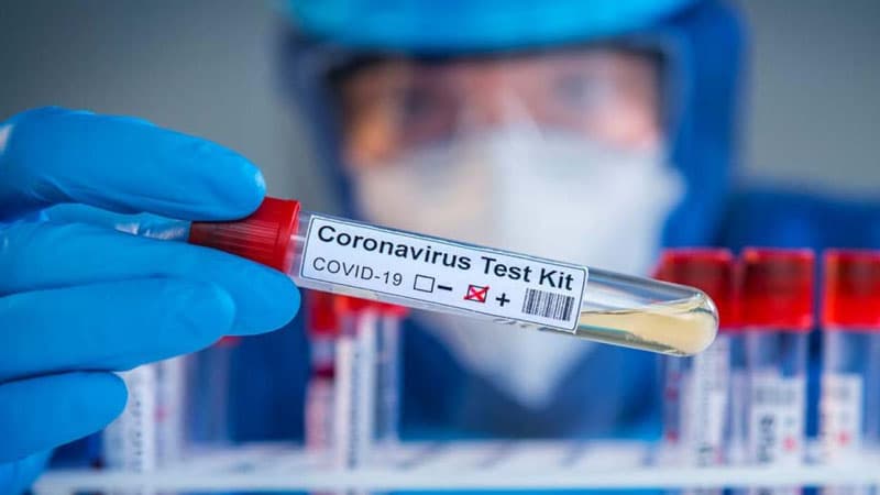Azərbaycanda indiyədək aparılmış koronavirus testinin sayı açıqlandı