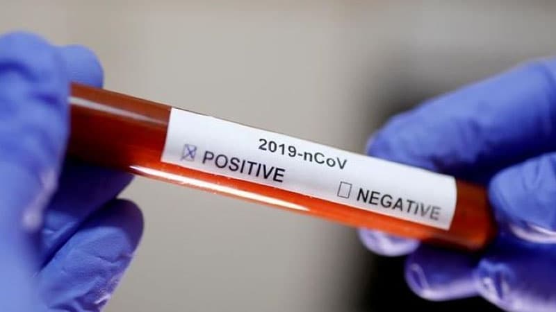 Bakıda koronavirus testi ilə bağlı klinikadan açıqlama