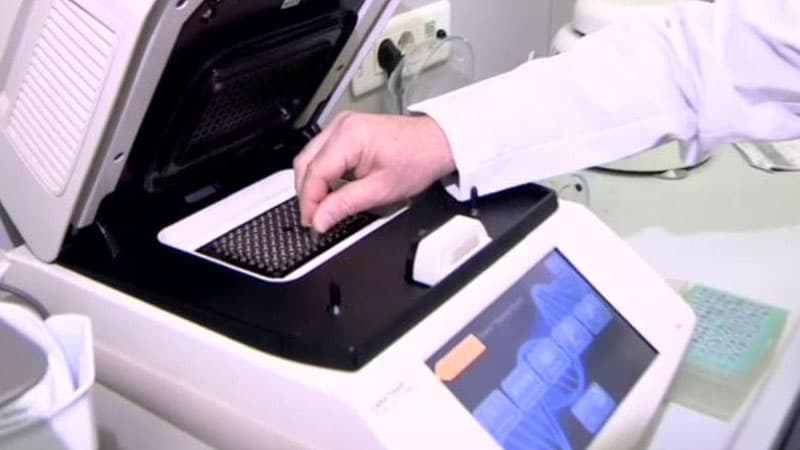 Deputatların koronavirus testinin nəticələri açıqlandı