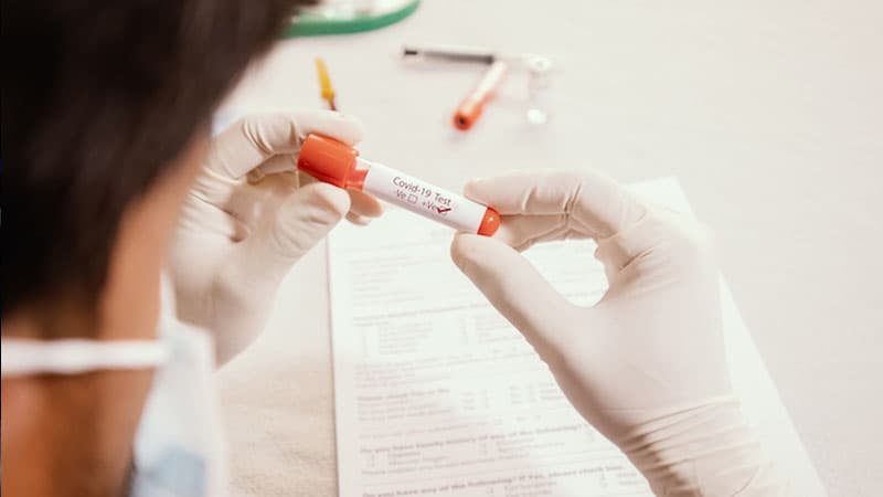 Azərbaycanda günün koronavirus statistikası: Yoluxma yenə 500-dən çox oldu, ölənlər var