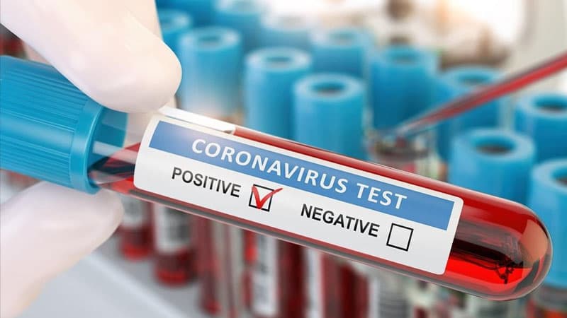 Son 24 saatda Azərbaycanda koronavirusa yoluxanların statistikası