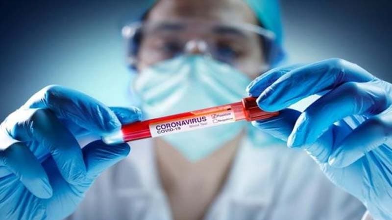 Rusiyada azərbaycanlı iş adamı və anası koronavirusdan öldü