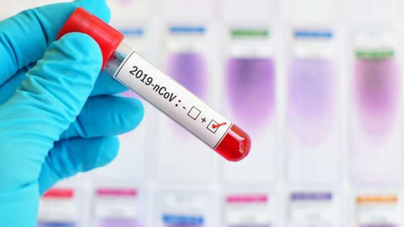TƏBİB koronavirusla bağlı son məlumatı açıqladı