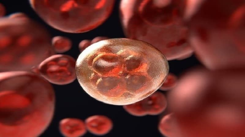 Onkoloji xəstəliklərin ilk 8 əlaməti bunlardır – Professor
