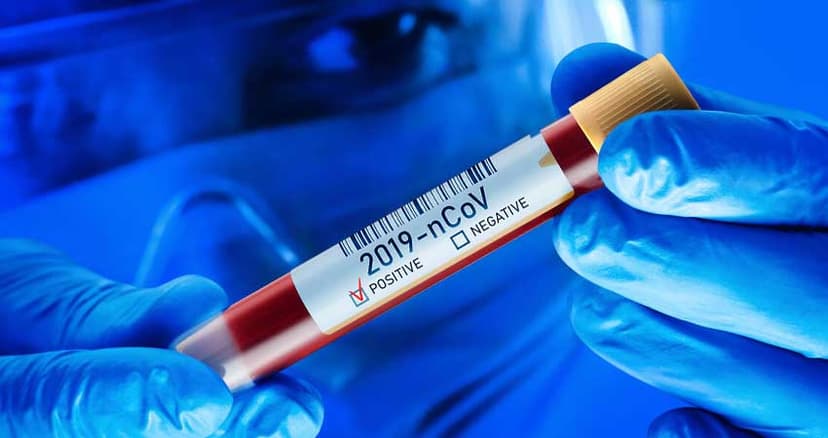 Bu gün təqdimatı olan məşhur futbolçuda koronavirus aşkarlandı