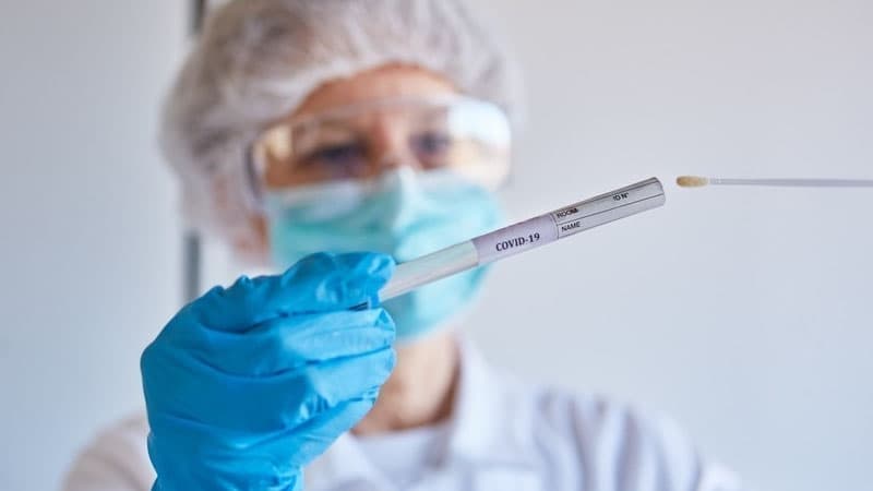 Reanimasiyada olan COVID-19 xəstələrinin sayı açıqlandı