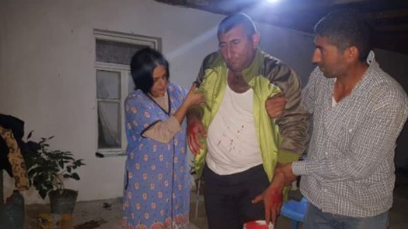 Ermənilərin yaraladığı mülki vətəndaşımız (FOTOLAR)