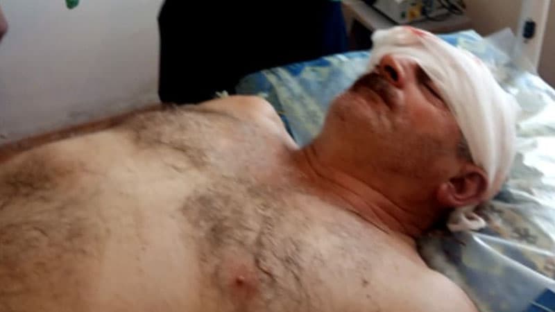 Ermənilərin Ağdam istiqamətində mərmi atəşi nəticəsində mülki şəxs yaralanıb