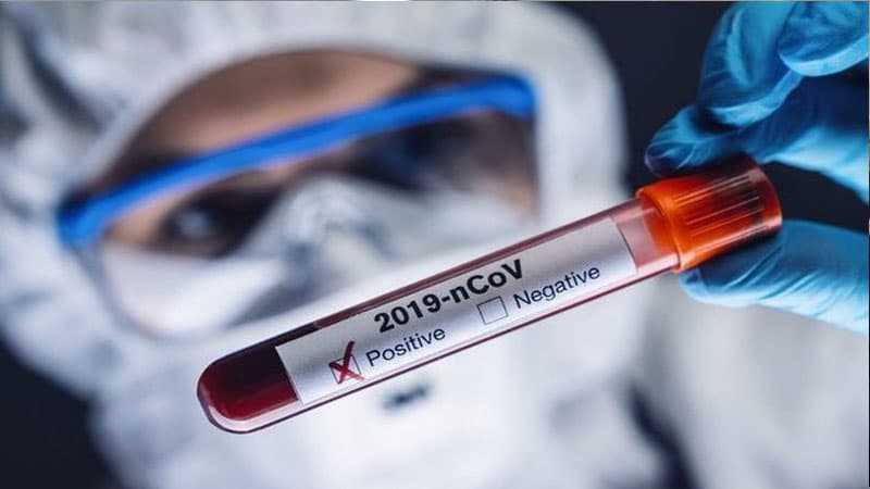Koronavirusa yoluxanların sayı 200-ə yaxınlaşdı - Günün statistikası