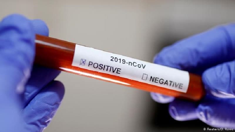 Hərbi xidmətə çağırılanlardan koronavirus testi götürülür