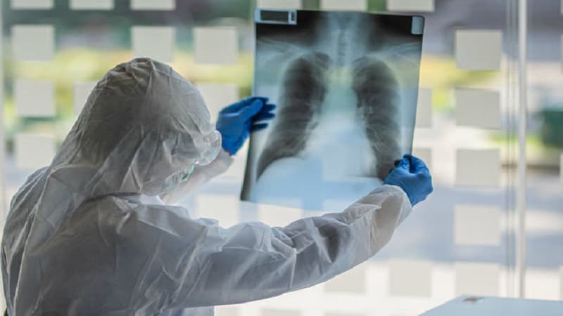 Buzlu şüşə diaqnozu qoyulan koronavirus xəstələri nə etməlidir?