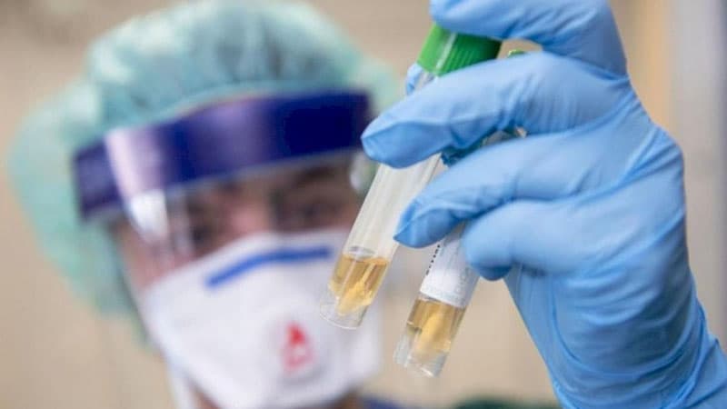 Azərbaycanda koronavirus testinin “əl yandıran“ qiyməti (VİDEO)