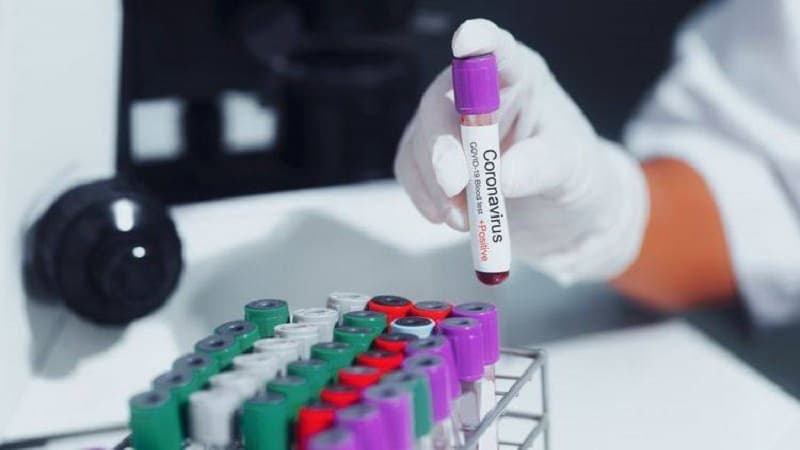 Azərbaycanda koronavirusa yoluxanların sayı azaldı