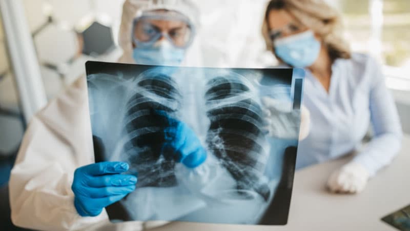 Koronavirus pandemiyasının bitəcəyi tarix açıqlandı
