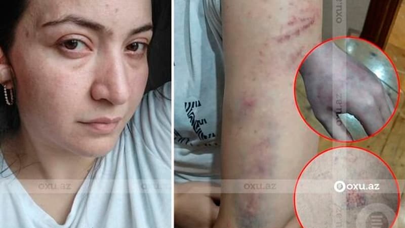 Şöbədə qətlə yetirilən qadının qardaşı gizlinləri açdı (FOTO)