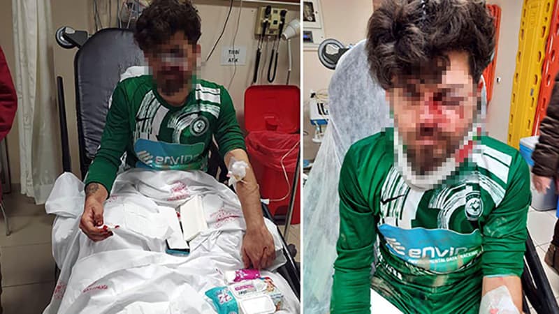 Futbolçu yerə yıxılan rəqibin üzünə təpiklə ağır xəsarət yetirdi (FOTO)
