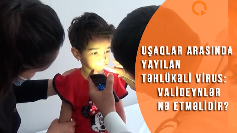 Uşaqlar arasında yayılan təhlükəli virus: valideynlər nə etməlidir? (VİDEO)