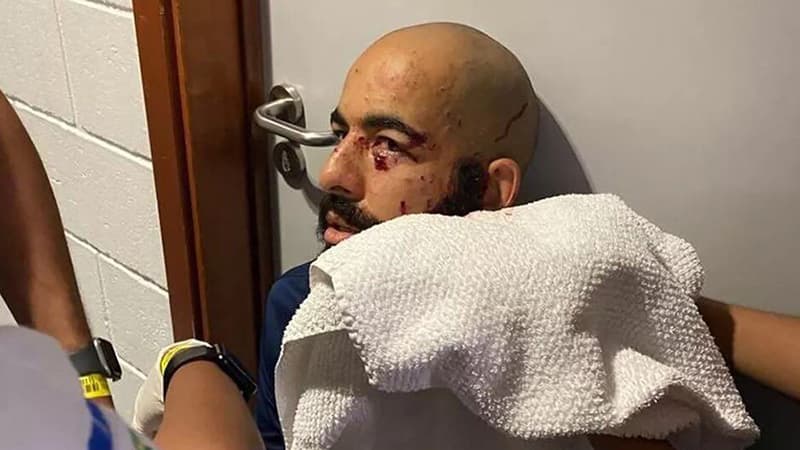Komandanın avtobusuna bomba atdılar, futbolçular yaralandı