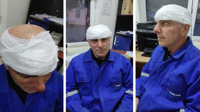 "Azəriqaz" İB-in əməkdaşı fiziki hücuma məruz qaldı
